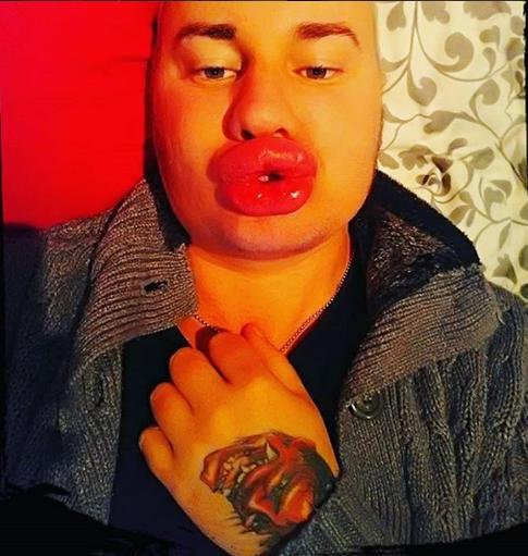 Француз переборщил с ботоксом, желая перевоплотиться в Мэрилин Монро