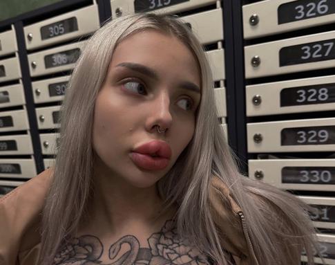 Блогерша Картье Бугатти едва не умерла после процедуры у косметолога