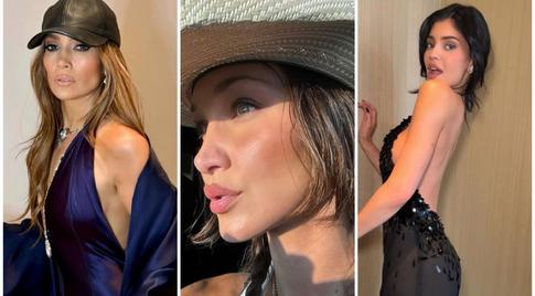 Тренды в пластической хирургии: эти процедуры стали популярными благодаря знаменитостям